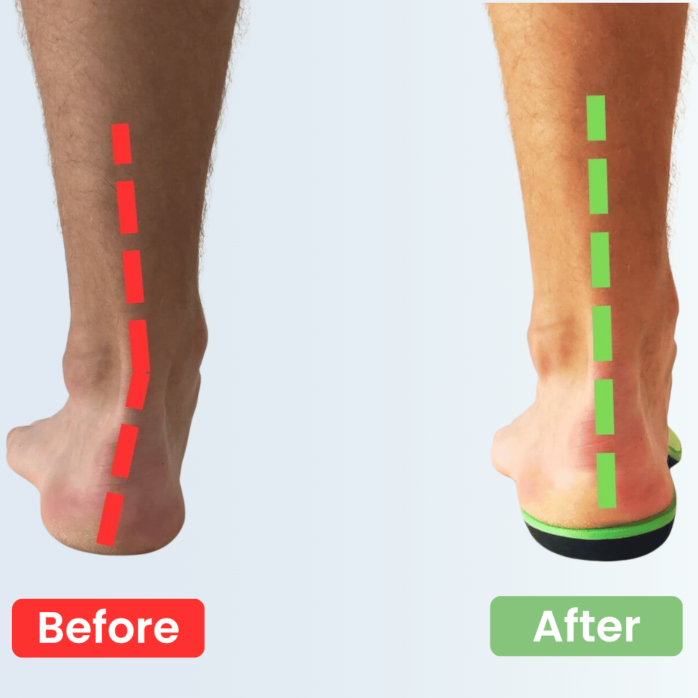 Medisole 3-Zone Align Insole