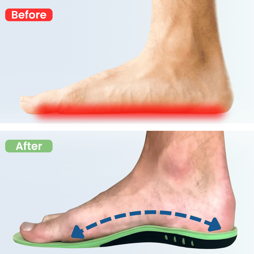 Medisole 3-Zone Align Insole